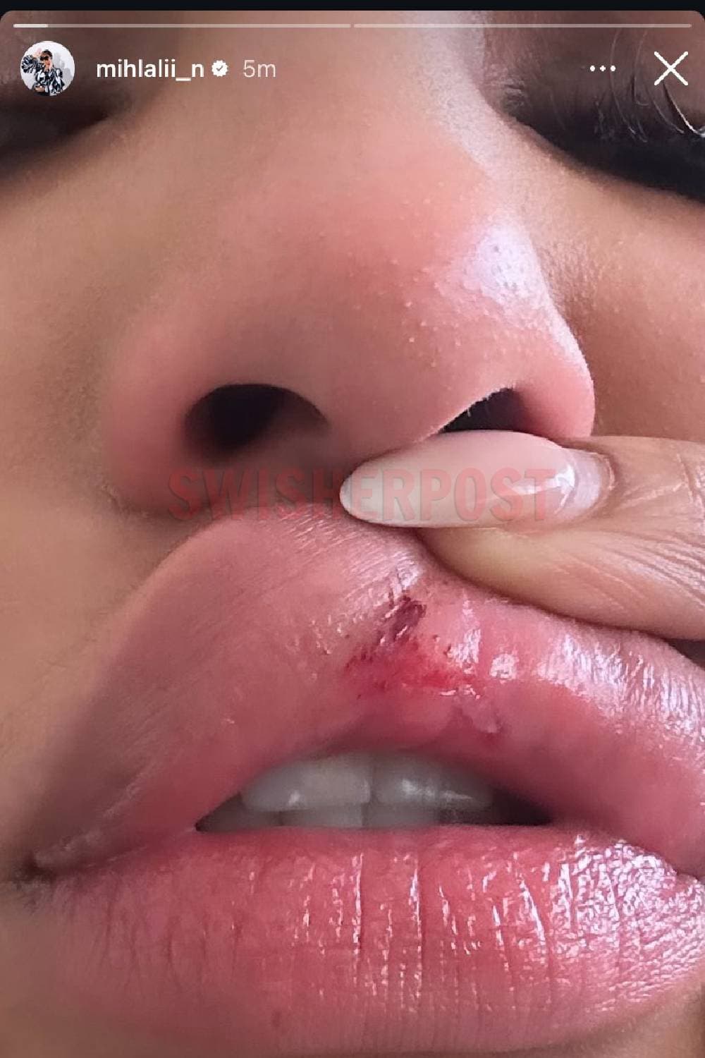 mihlali ndamase abuse pics