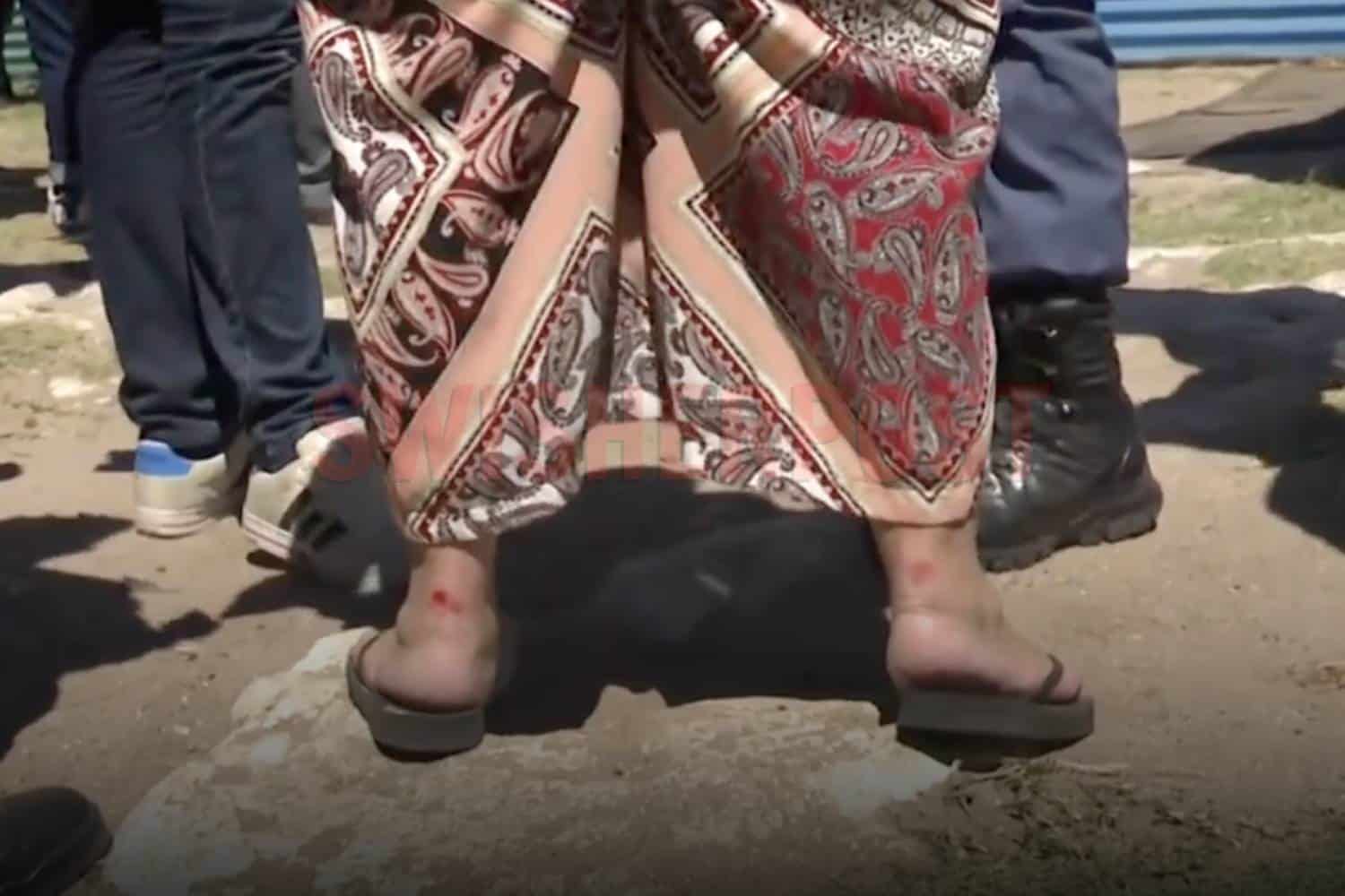 kelly smith injured heels from shackles