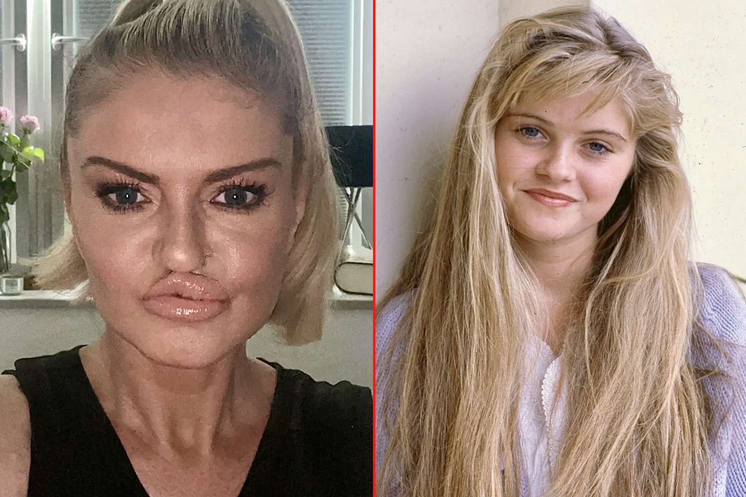 danniella westbrook face surgery new look